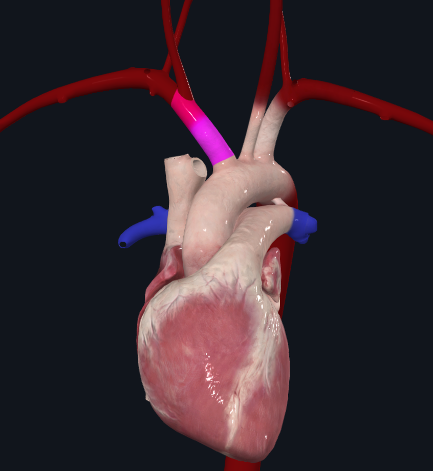 Brachiocephalic trunk branching from the aortic arch