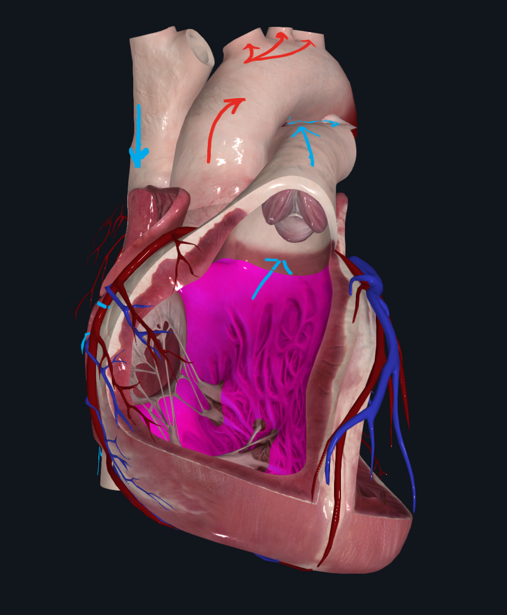 Right Ventricle