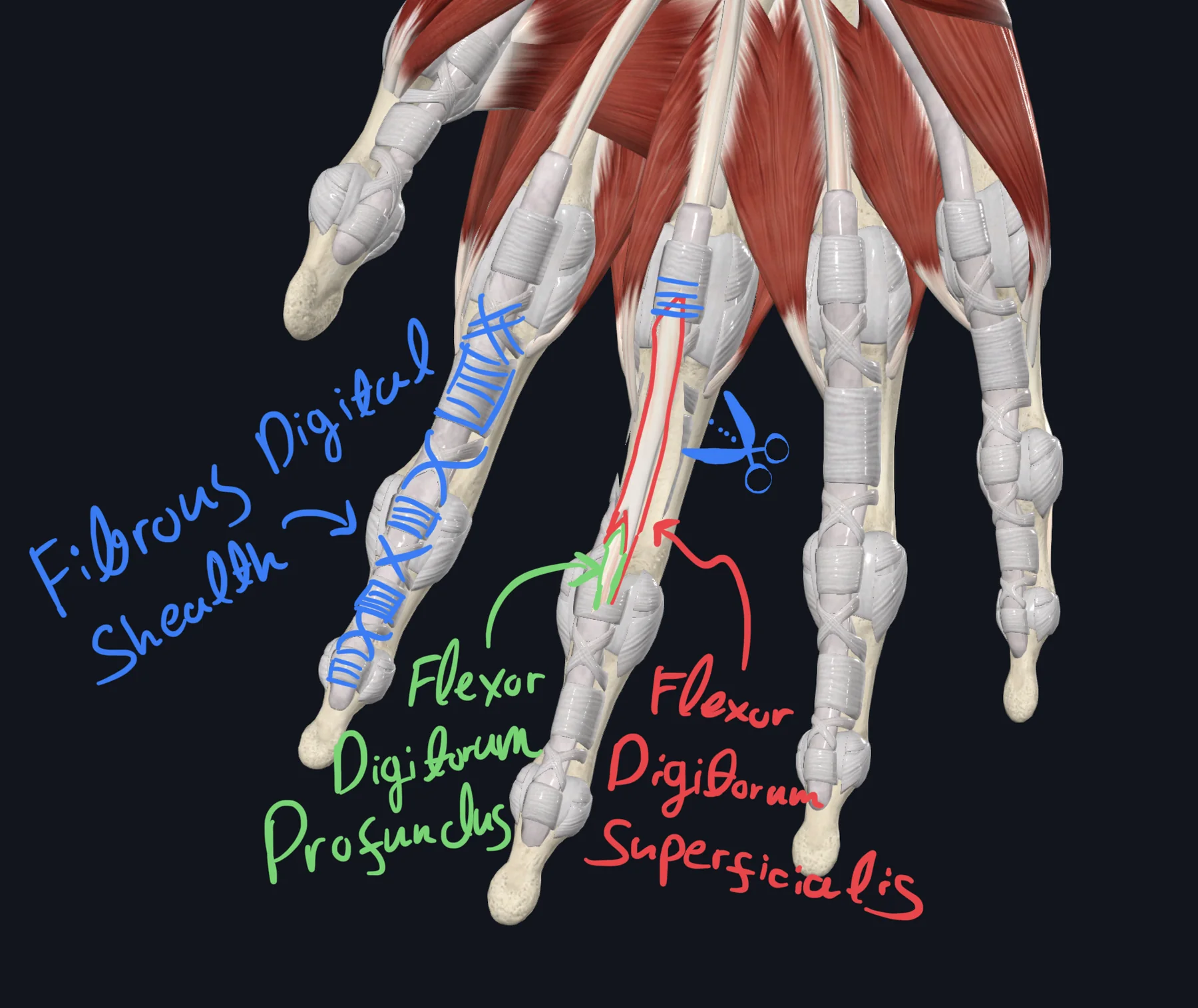 Fibrous Digital Sheath