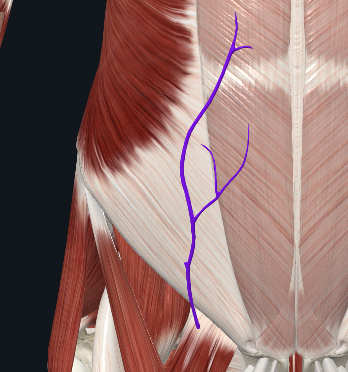 Superficial epigastric vein (Right)