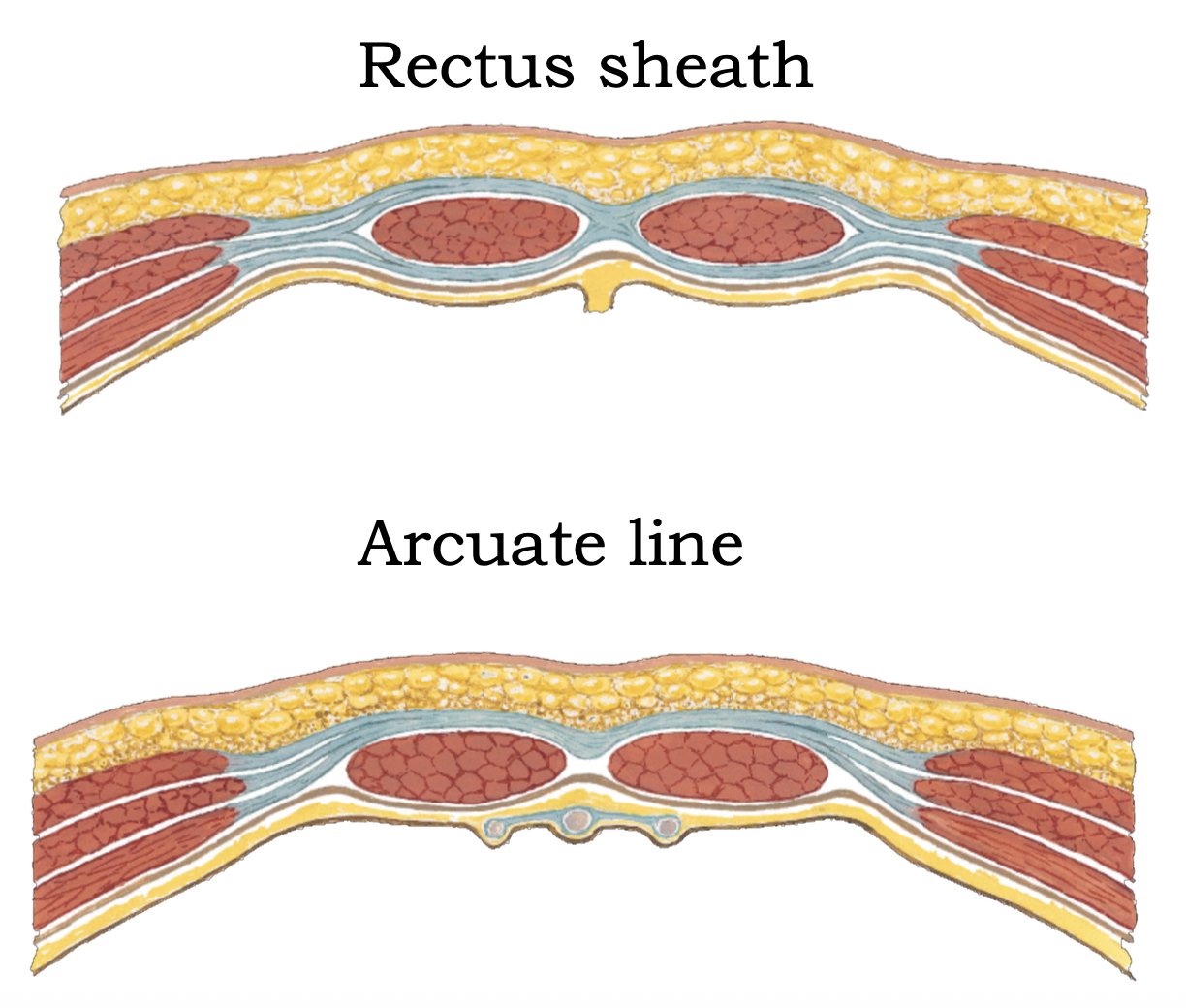 rectus shealth and arcuate line