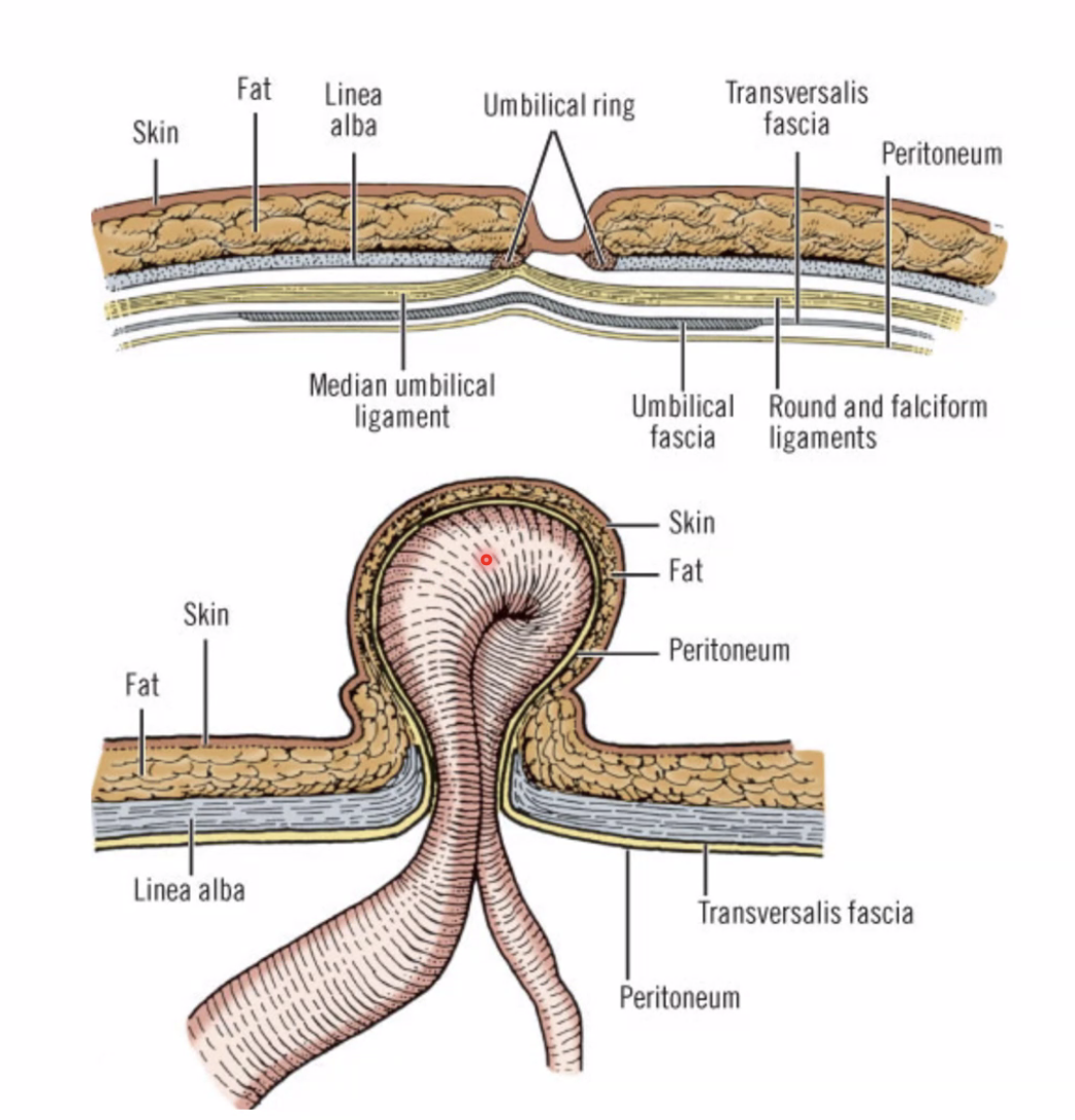 יצירה הנריה