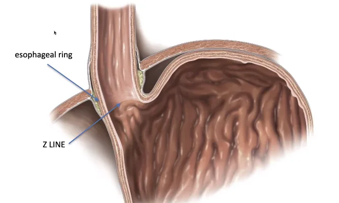 Esophagogastric Junction