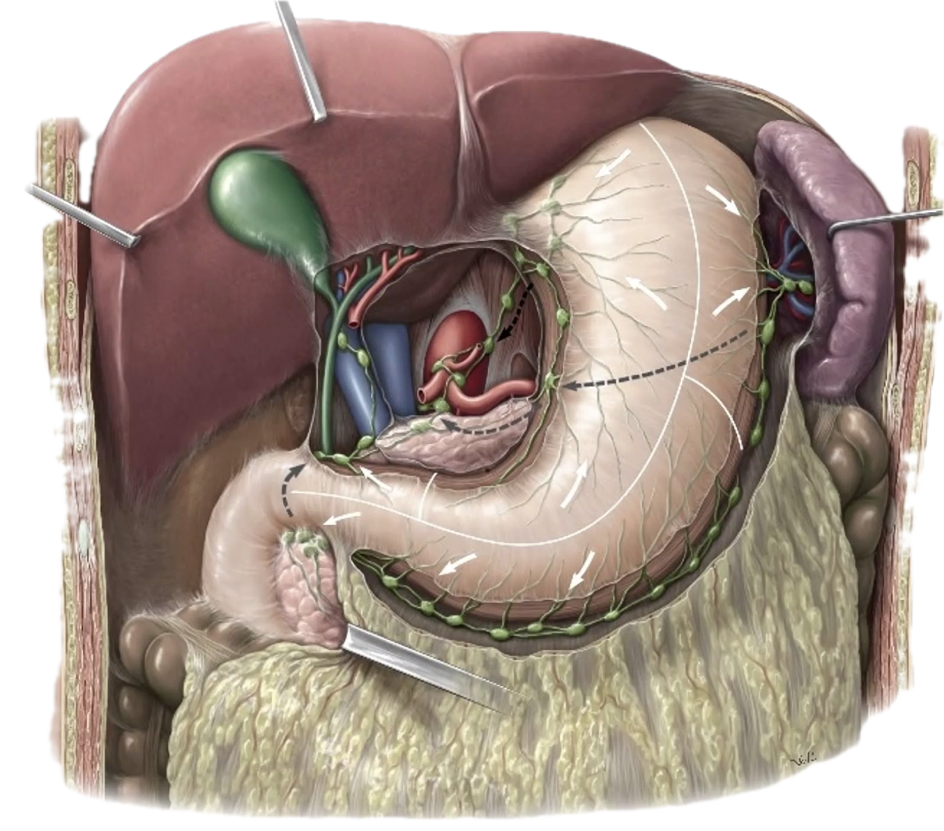 ניקוז לימפתי