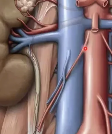 Right Gonadal Vein