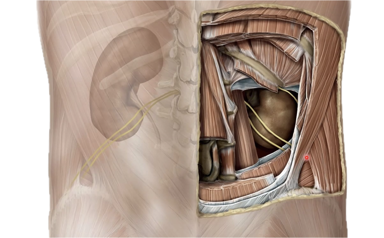 כלייה ימנית 