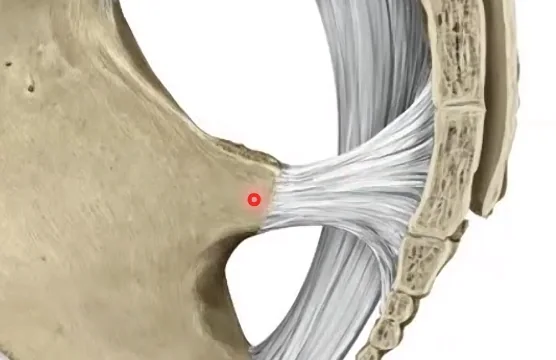 Sacrotuberous