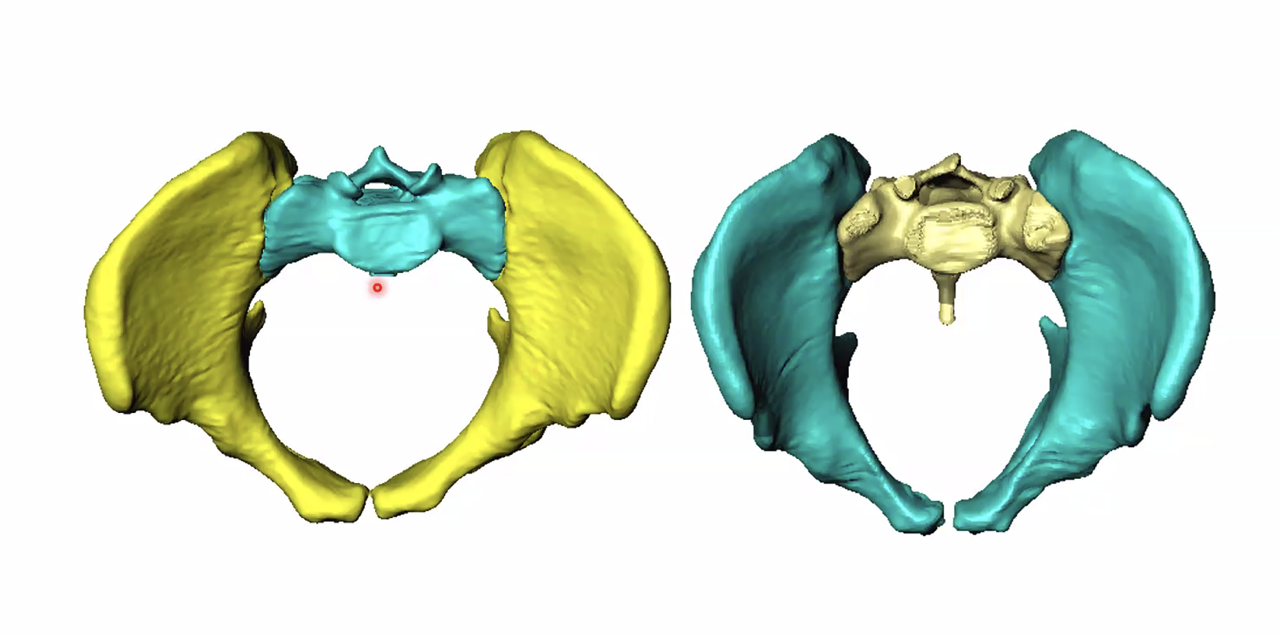 צילום מלמעלה - גבר לעומת אישה