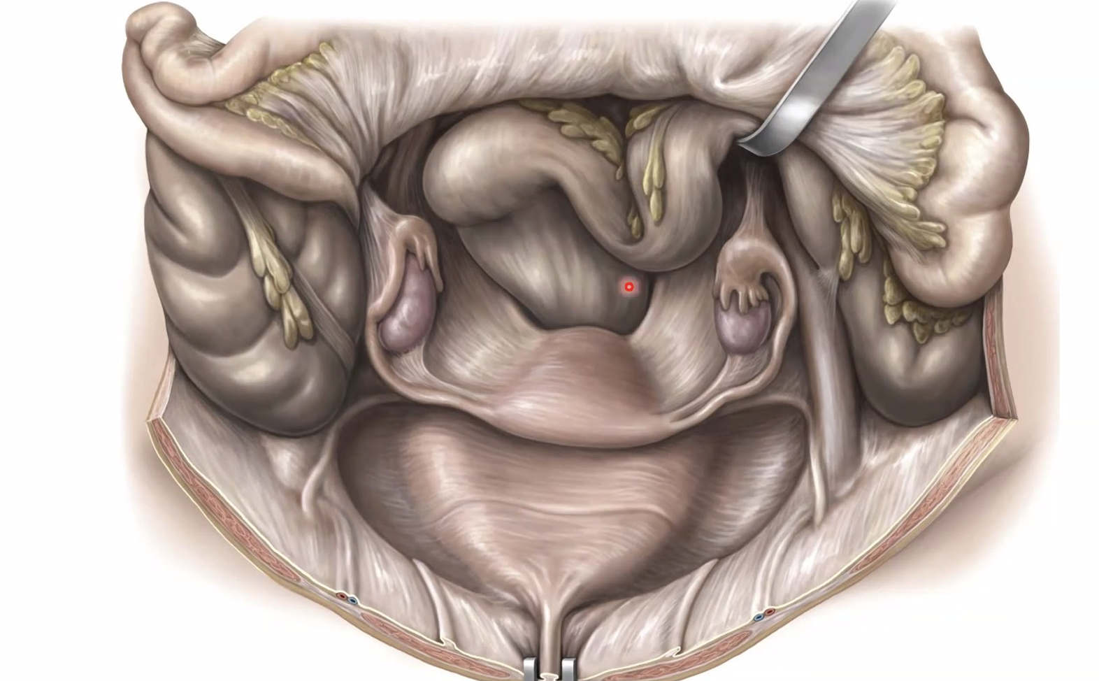 שק דגלס מלמעלה