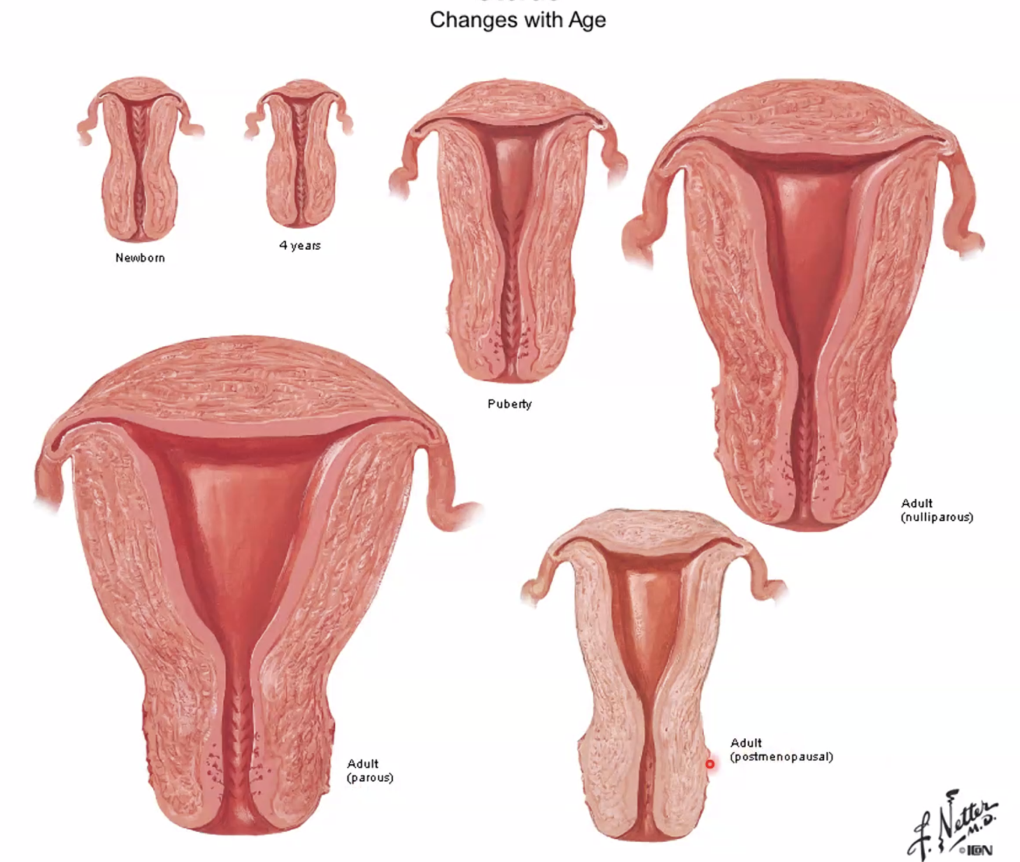 רחם - הבדלים לפי גיל ולידות