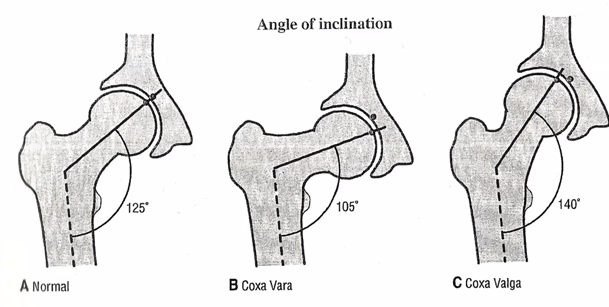 Angle of Inclination
