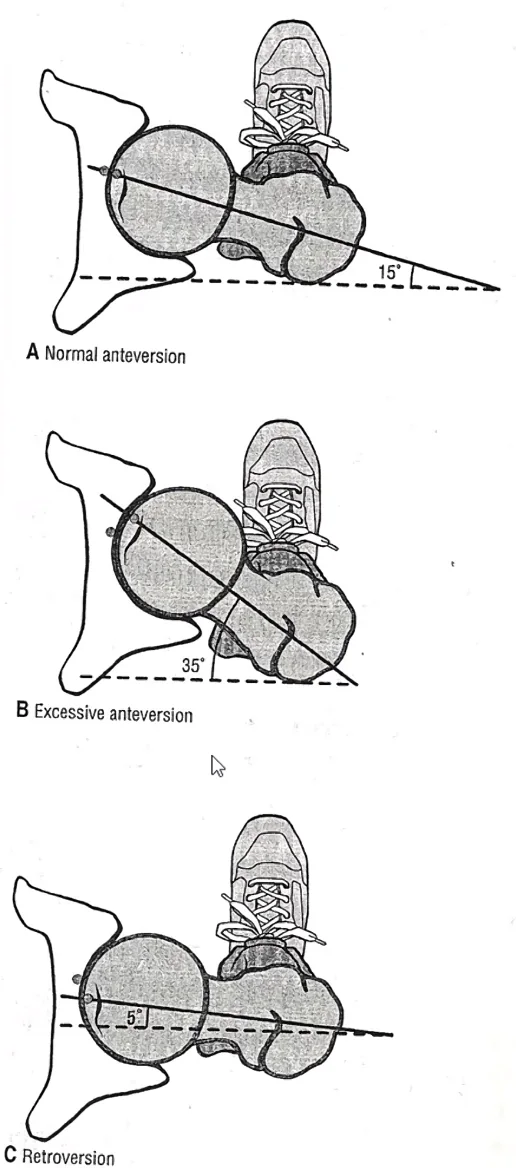 Angle of torsion