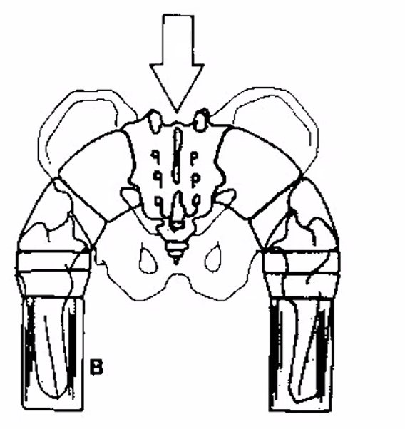 Sacroiliac Joint