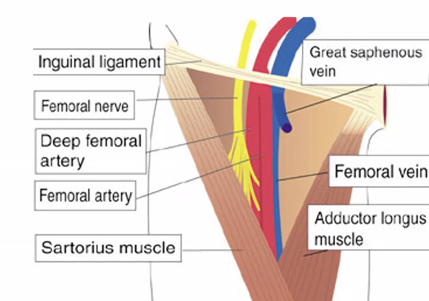 המשולש הפמורלי