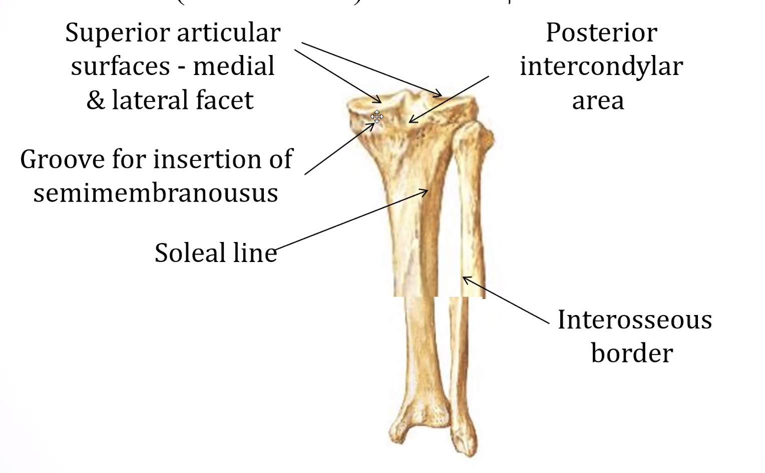 מבט פוסטריורי - טיביה