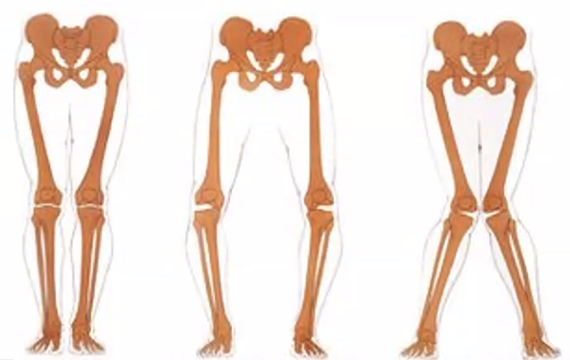 מנחי ברכיים