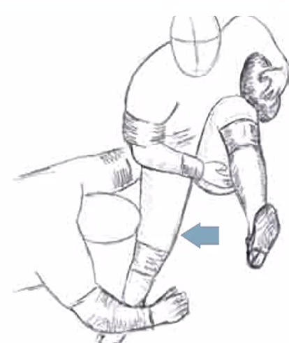 Medial Collateral Ligament