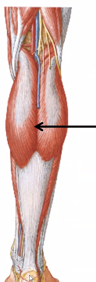 Gastrocnemius