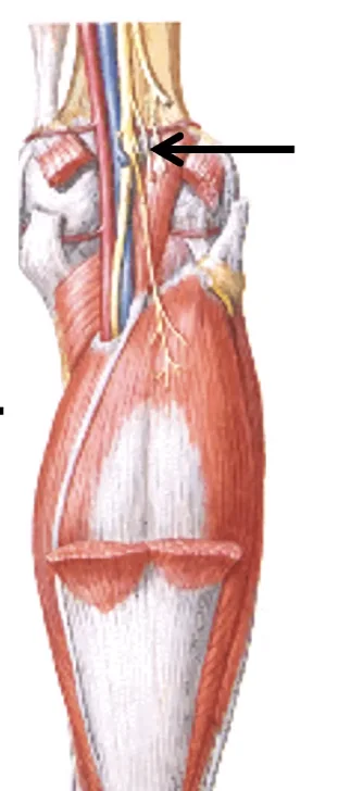 Plantaris