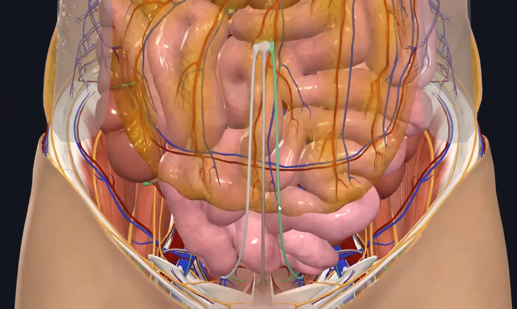 Medial Umbilical Ligaments
