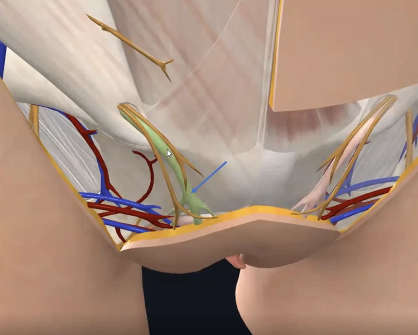 Round ligament