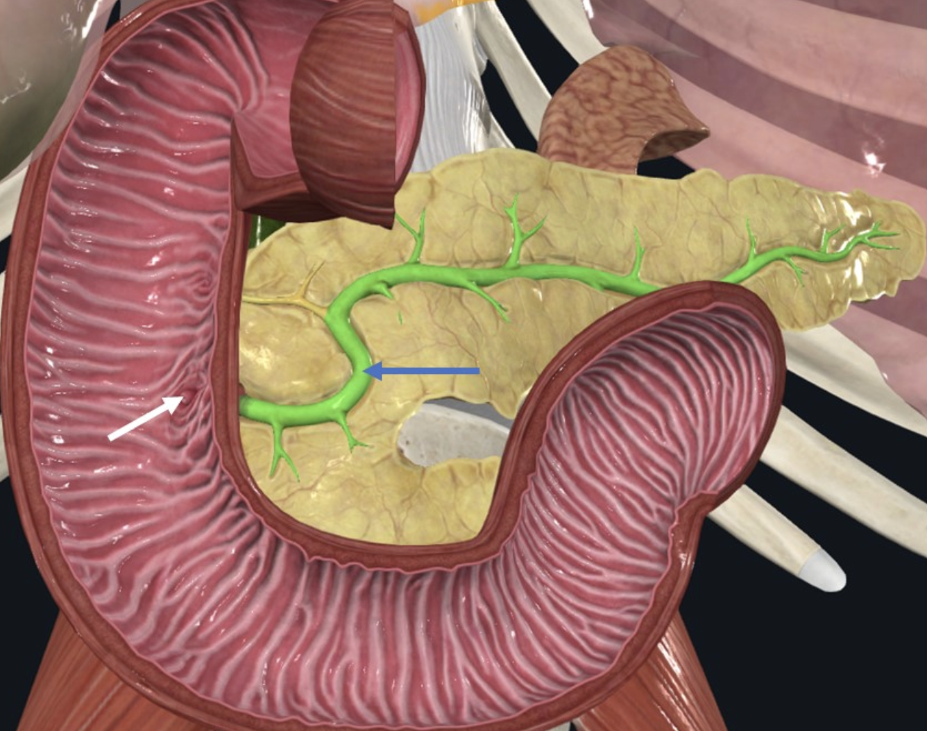 ה־Pancreatic duct הנו צינור ההפרשה האקסוקרינית של הלבלב. הצינור חולף בתוך הלבלב ונפתח באזור החלק השני של הטריסריון, ב־Major duodenal papilla בדומה לצינור המרה.