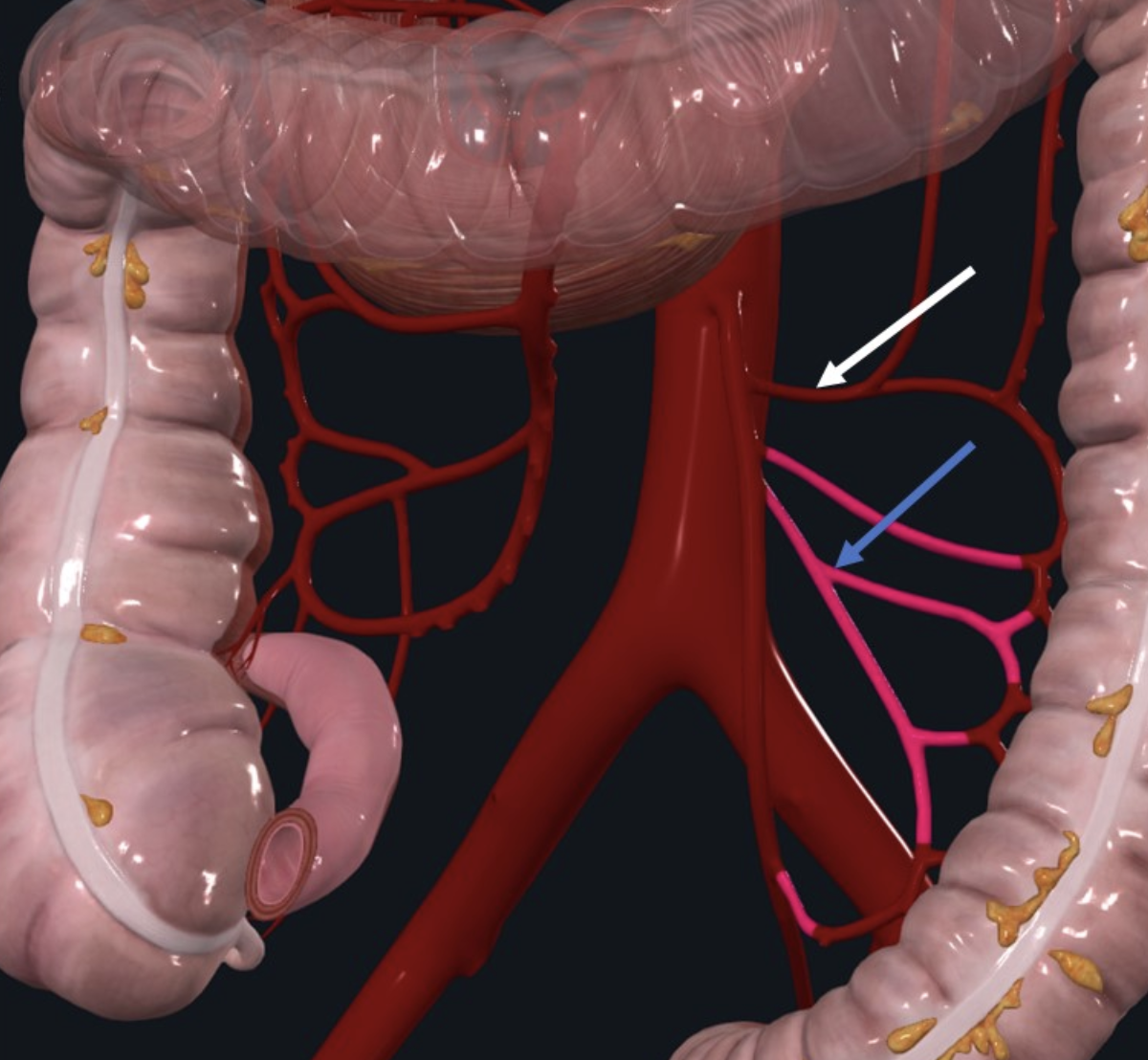 Sigmoid Arteries מסומנים בתמונה בחץ כחול. מקום ב־IMA. ה־Left colic מסומן בחץ לבן