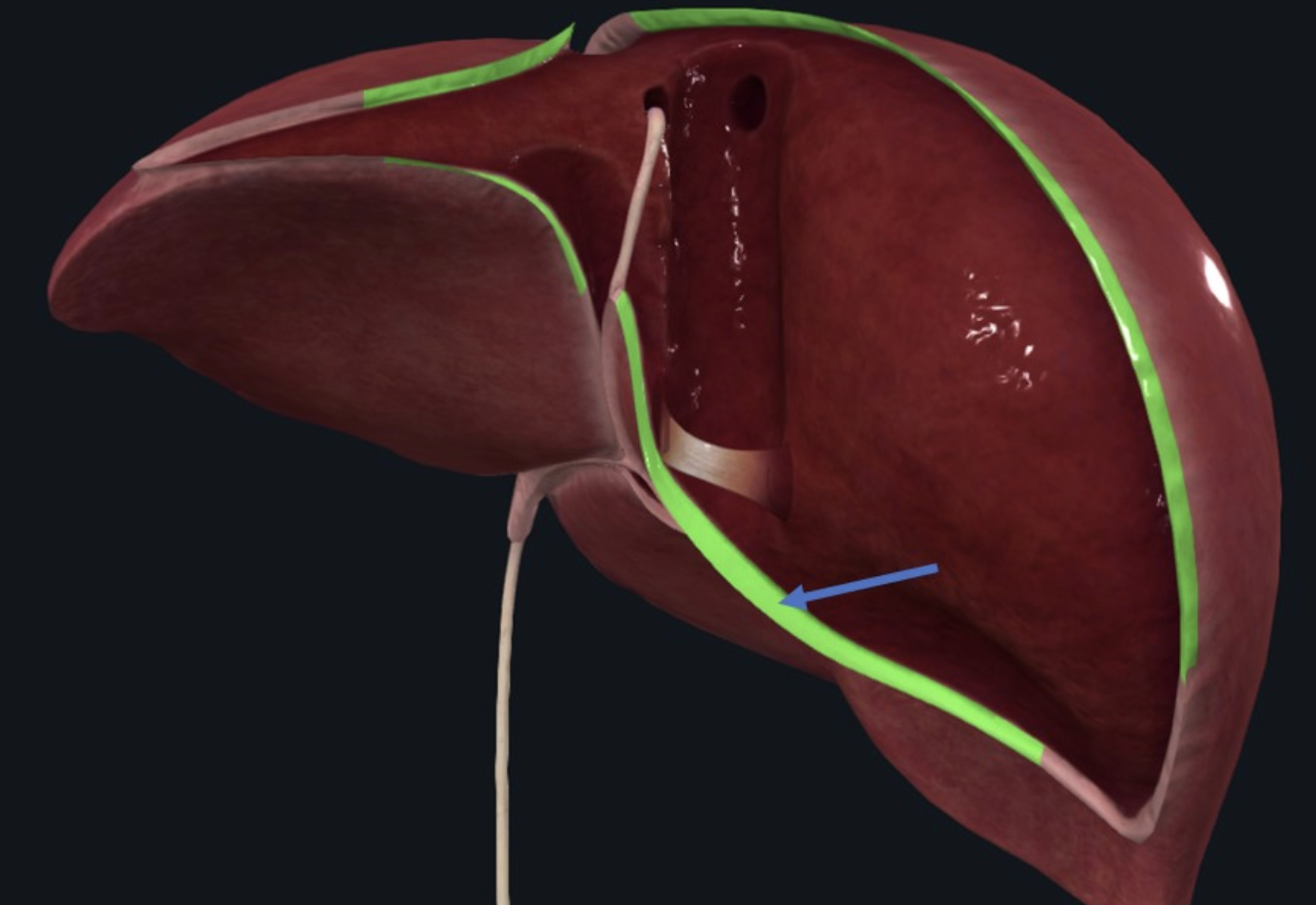 Coronary Ligament היא המשכה של ה־Falciform ligament בחלקו הסופריורי של הכבד. הרצועה מכתרת את ה־Bare area של הכבד ומחברת את הכבד לסרעפת.