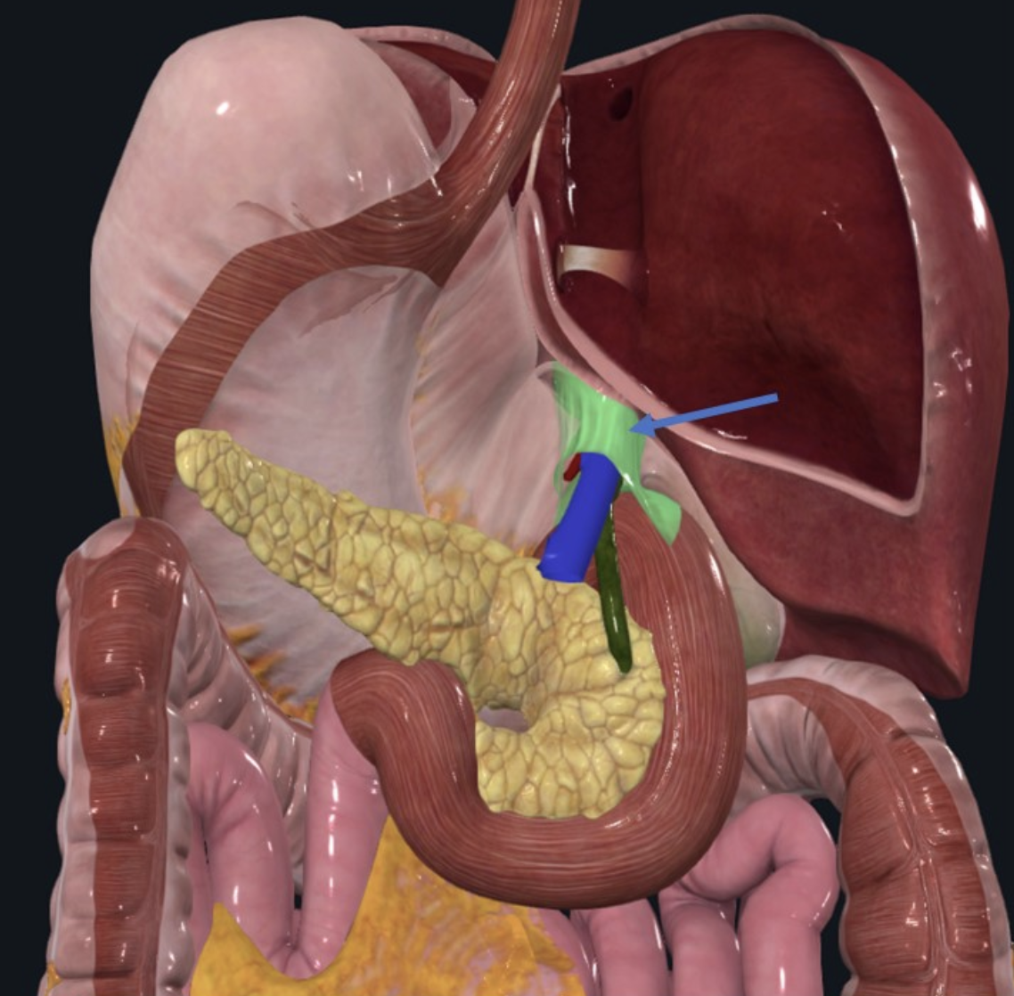 Hepatoduodenal ligament מסומן בתמונה. עוברים בו צינור המרה, הווריד הפורטלי ועורק הכבד