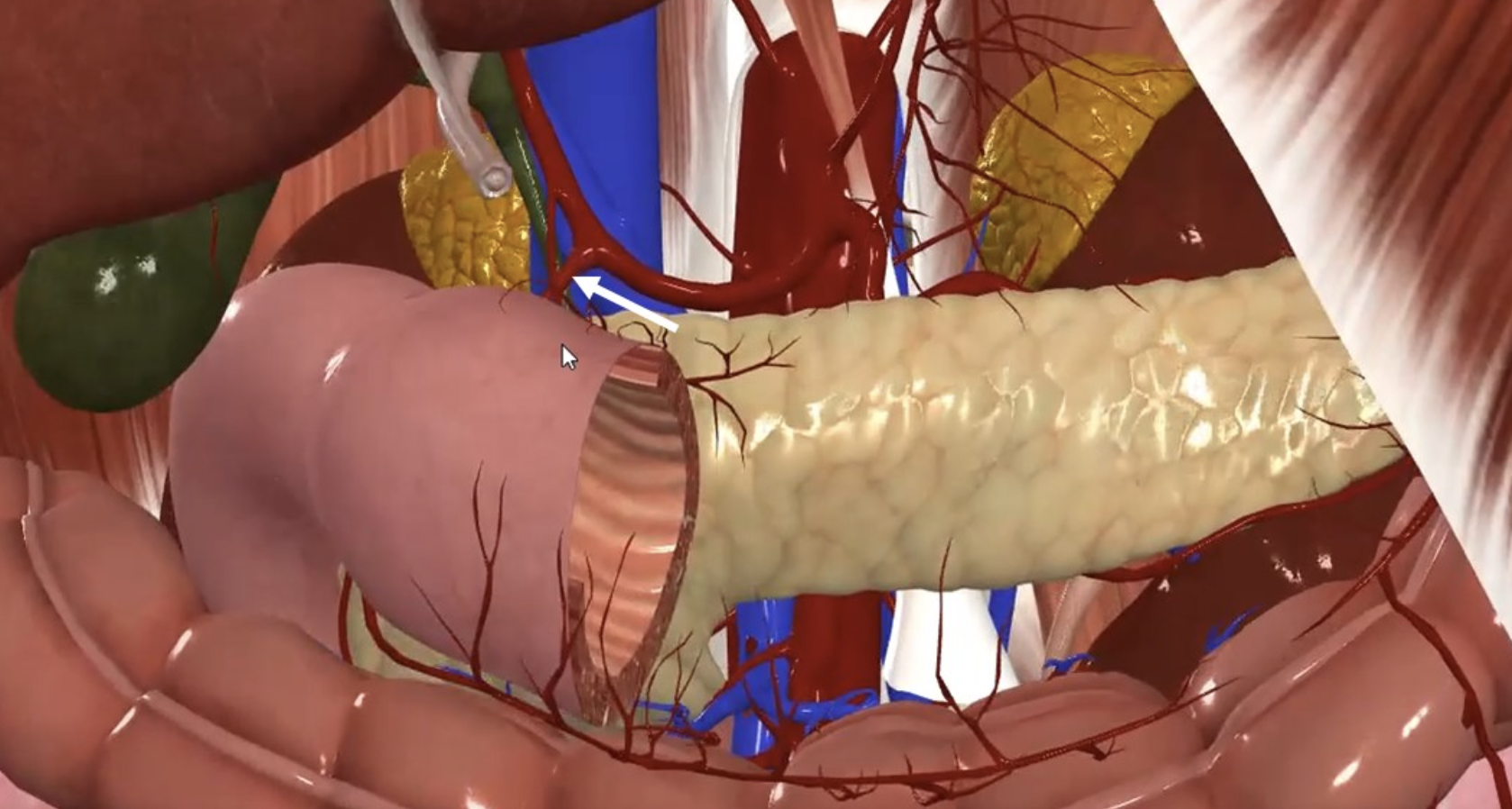 Gastroduodenal Artery
