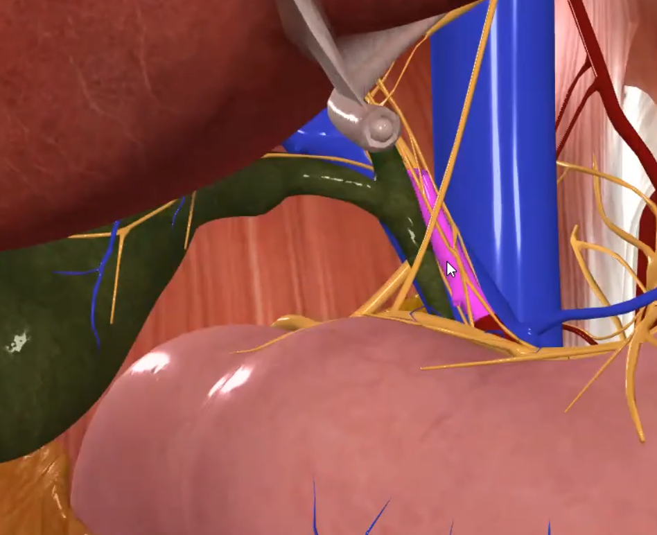 Proper Hepatic Artery