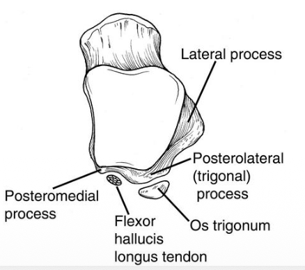 עצם אקססורית - לא חייבת להיות