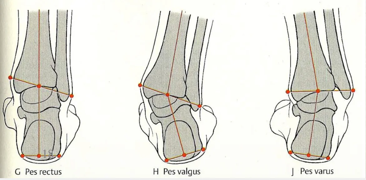 Pes Types