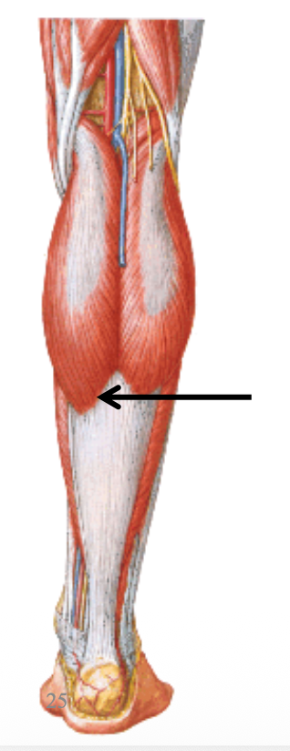 Gastrocnemius