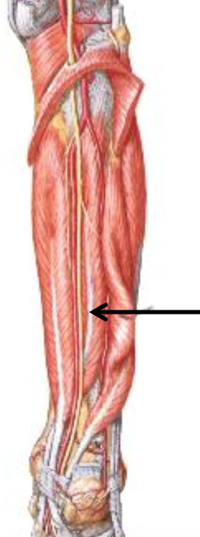 Tibialis Posterior