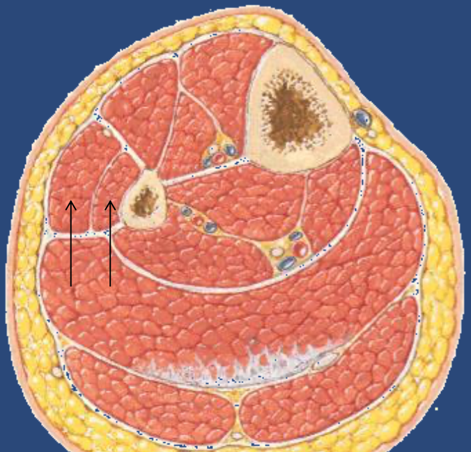 Lateral compartment