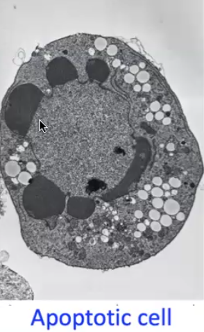 Apoptotic cell