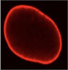 Normal Cell