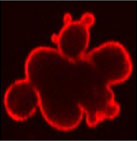 Progeria Cell