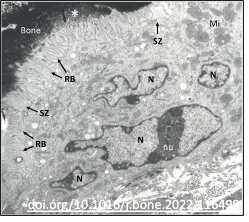 Osteoclasts