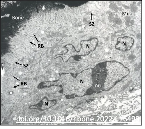 Osteoclasts