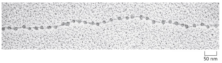 Beads on a String