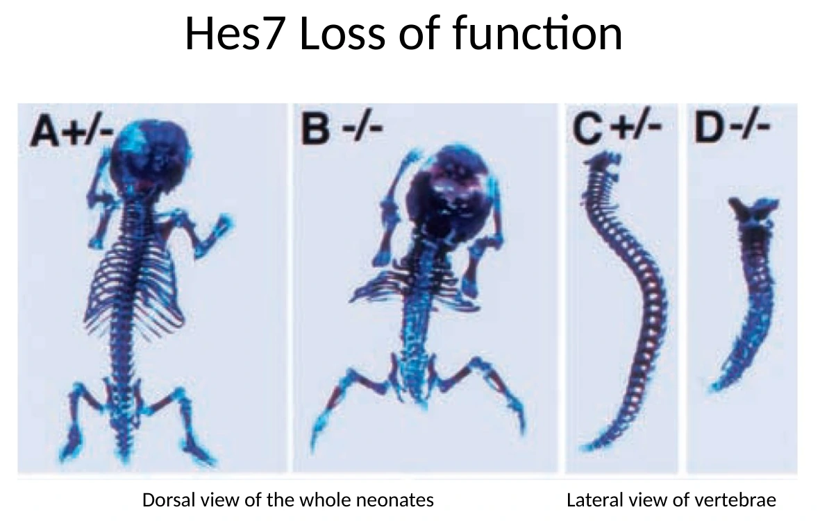 ב־Hes7 loss of function רואים פגיעה קשה בסגמנטציה של השלד: החוליות והצלעות אינן מאורגנות כסגמנטים תקינים.