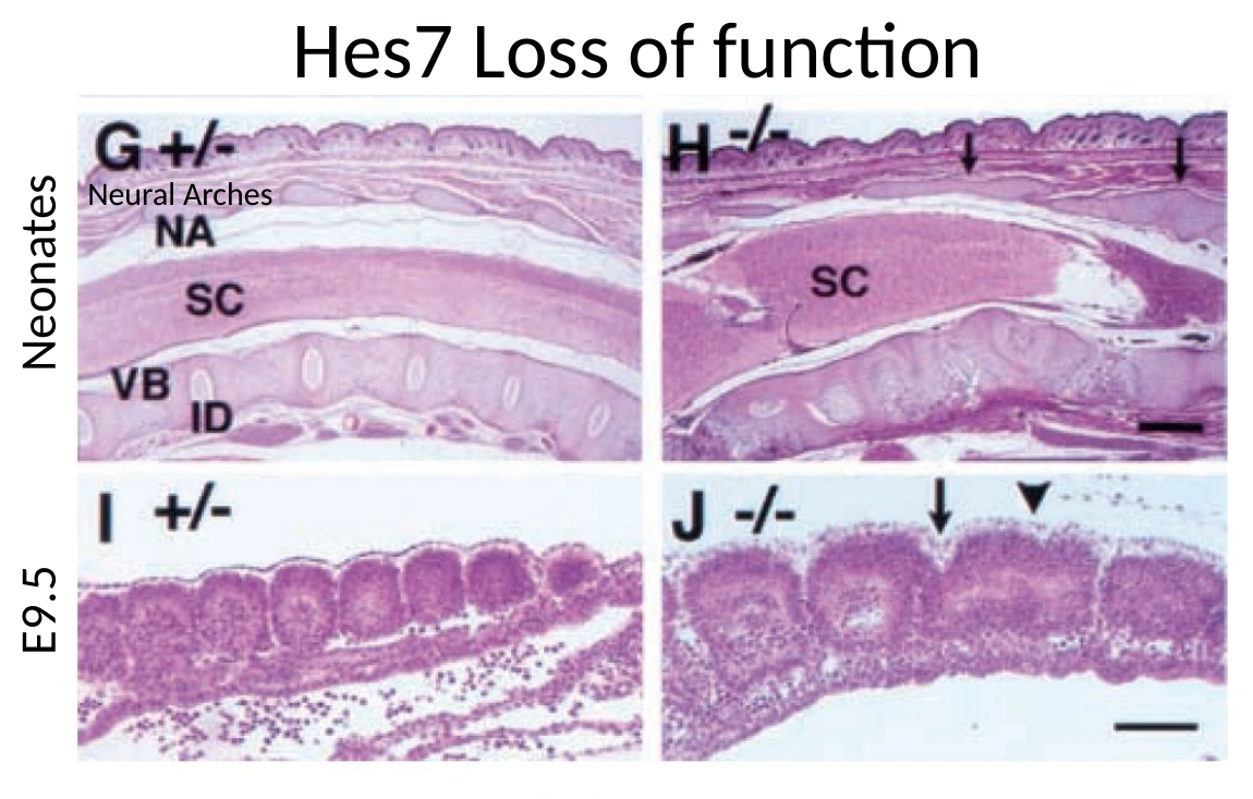חתכים בעכברי Hes7 loss of function: Neural arches וחוליות מאוחות, לצד סומיטים לא סדירים בשלבים עובריים.