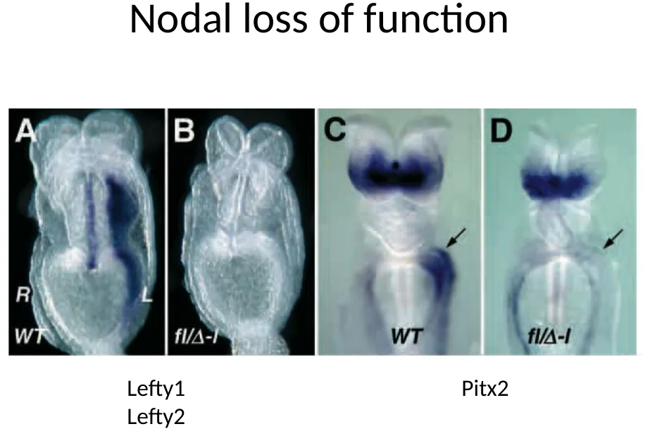 Nodal loss of function: אובדן ביטוי Lefty1, Lefty2 ו־Pitx2