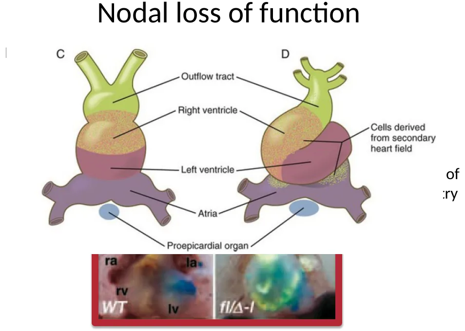 Nodal loss of function: רנדומיזציה של כיוון heart tube looping