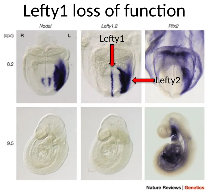 Lefty1 loss of function: ביטוי Nodal/Lefty2/Pitx2 מופיע גם בצד ימין