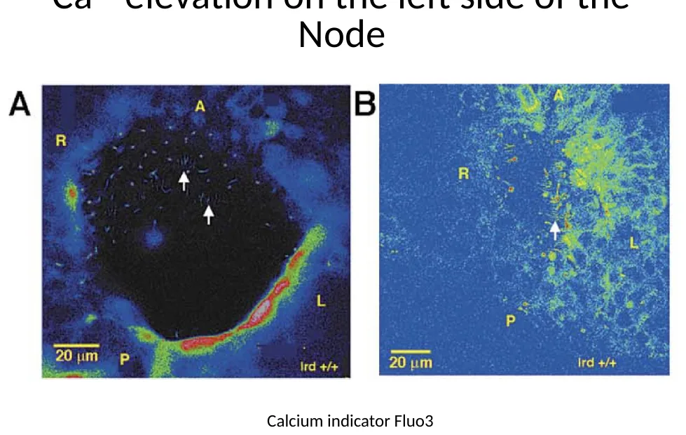 Ca²⁺ elevation בצד שמאל של ה־Node