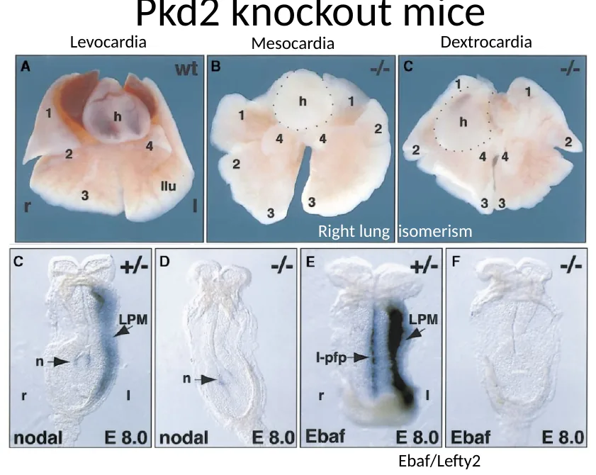 Pkd2 knockout: פנוטיפים לבביים וריאתיים ואובדן ביטוי שמאלי של Ebaf/Lefty2