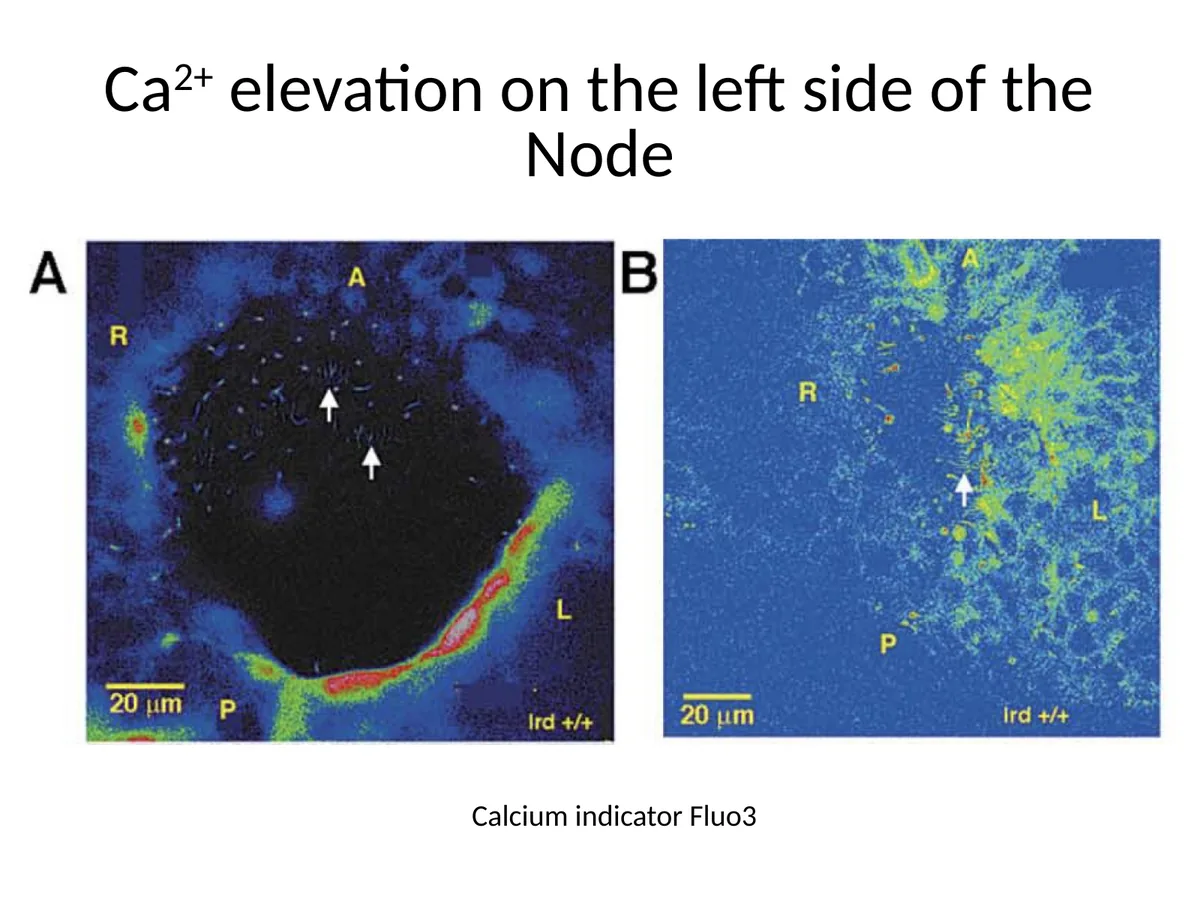 עלייה ב־$\ce{Ca^{2+}}$ בצד שמאל של ה־Node, לפי Fluo3.